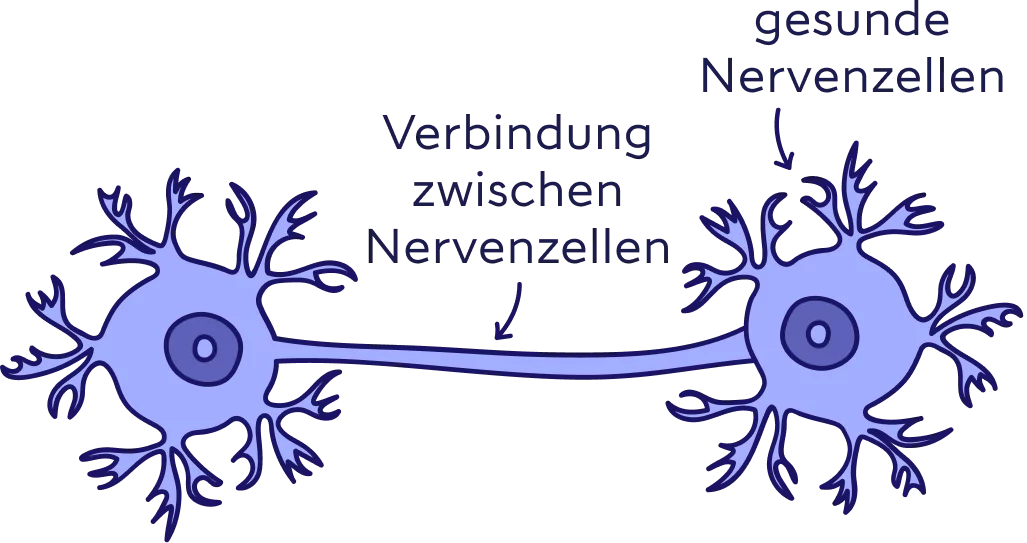 Zwei gesunde Nervenzellen und deren funktionierende Verbindung. 